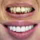 Slider image (9) Astra Dental Clinic